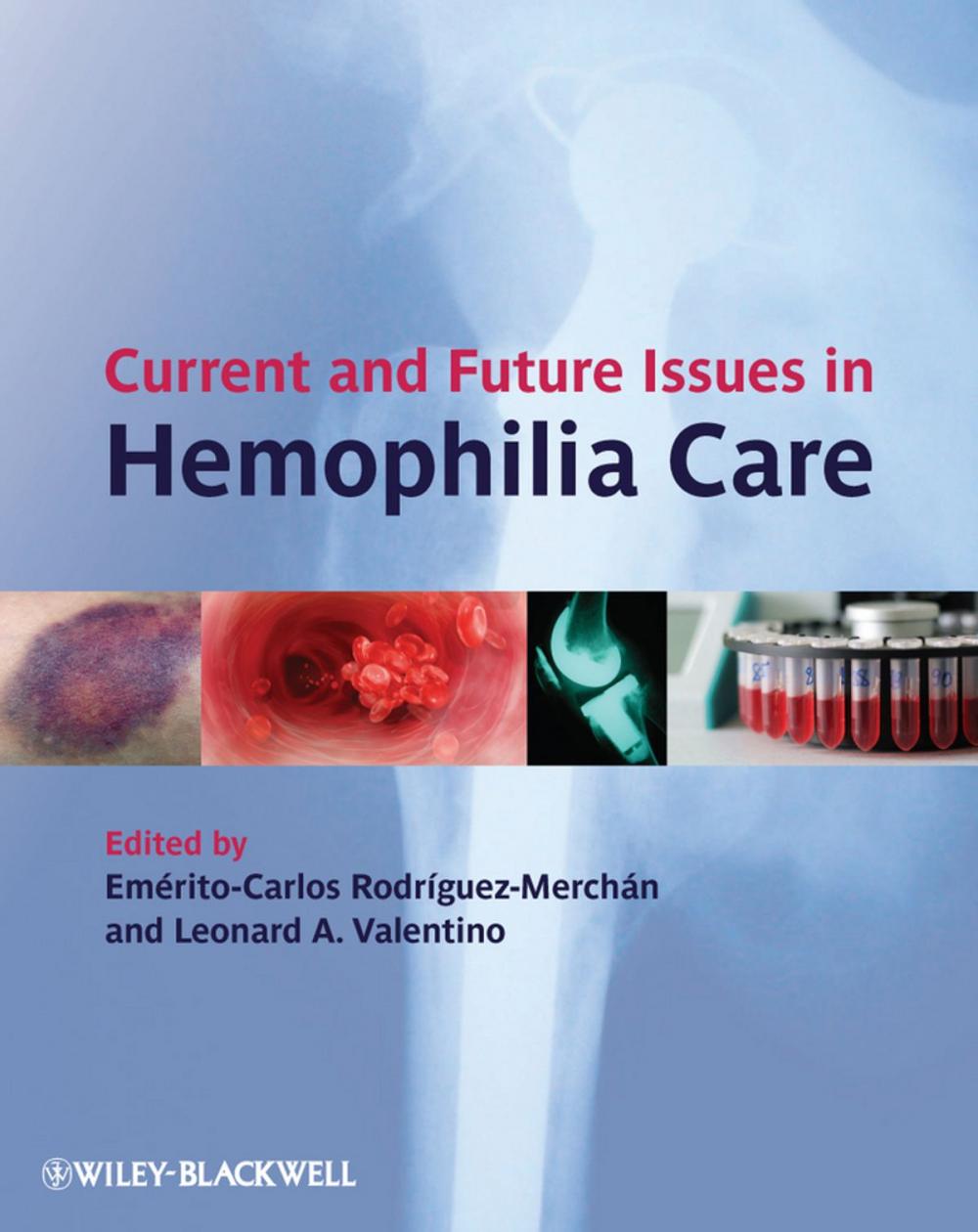 Big bigCover of Current and Future Issues in Hemophilia Care