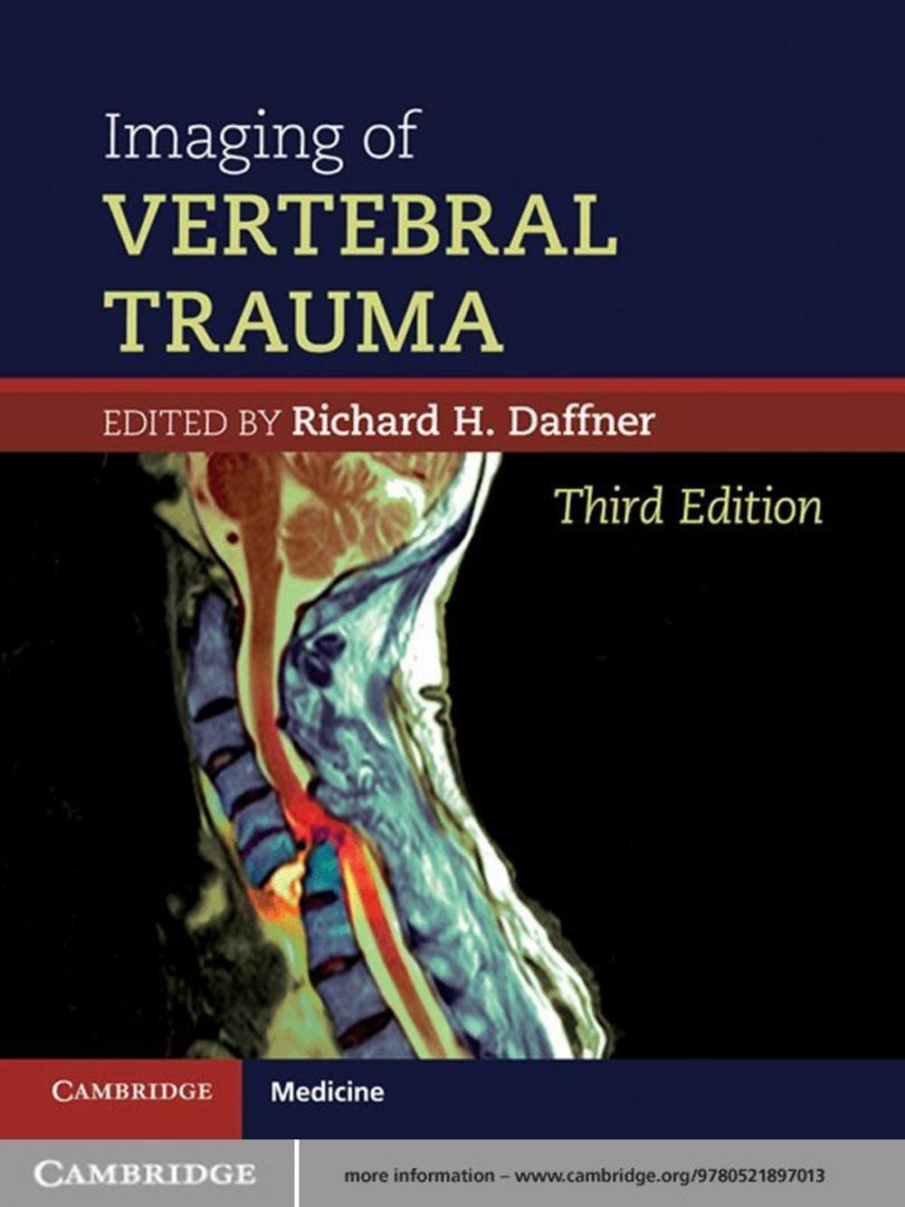 Big bigCover of Imaging of Vertebral Trauma