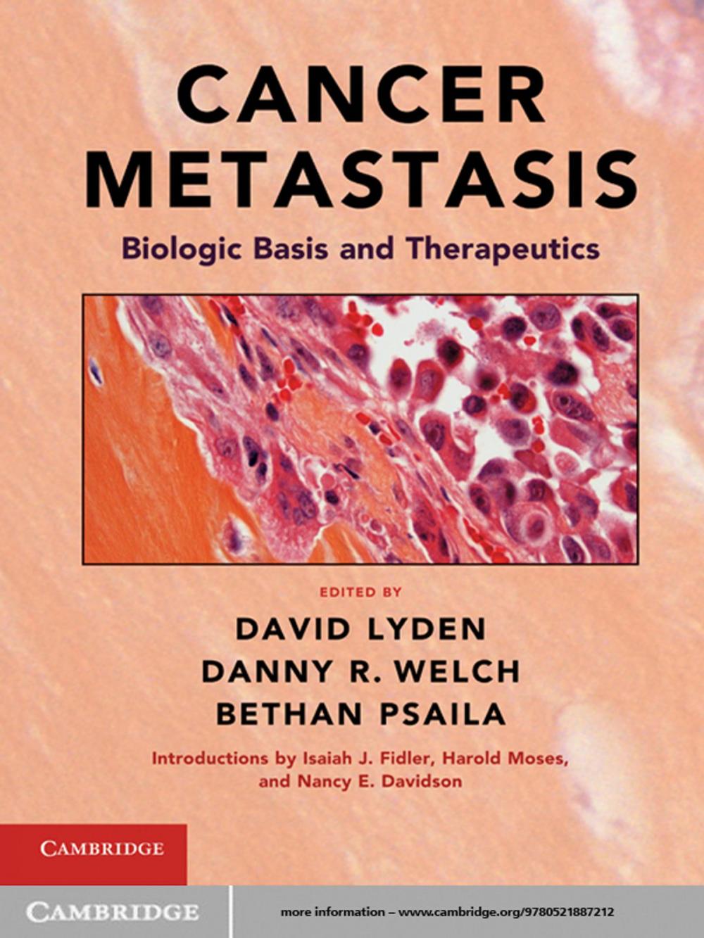 Big bigCover of Cancer Metastasis