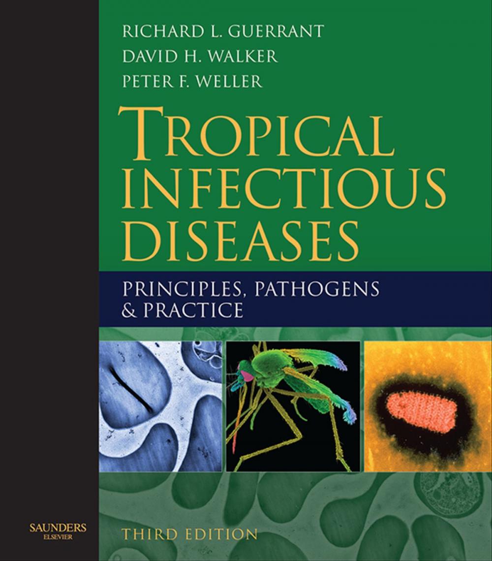 Big bigCover of Tropical Infectious Diseases: Principles, Pathogens and Practice E-Book