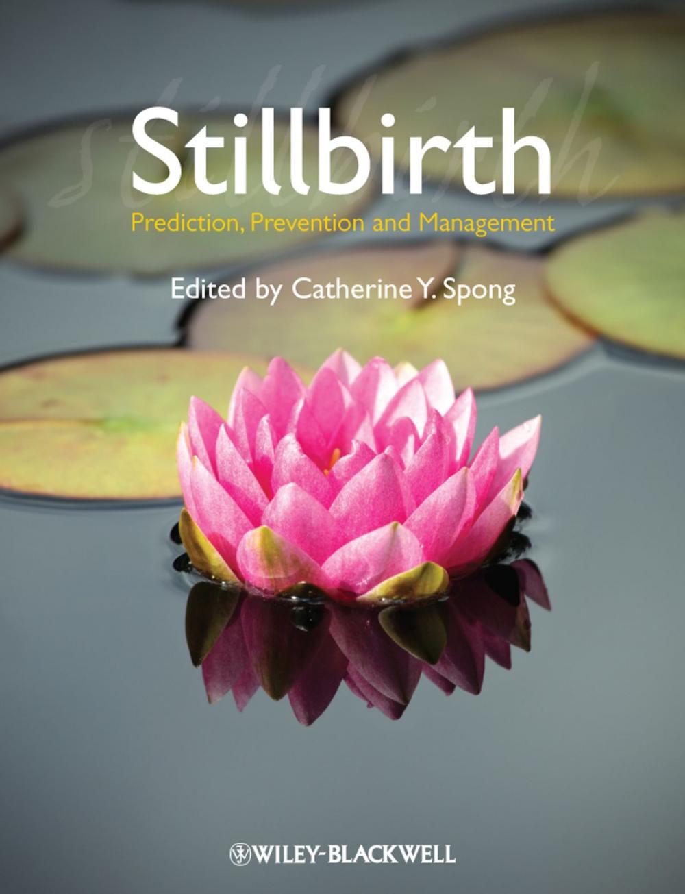 Big bigCover of Stillbirth