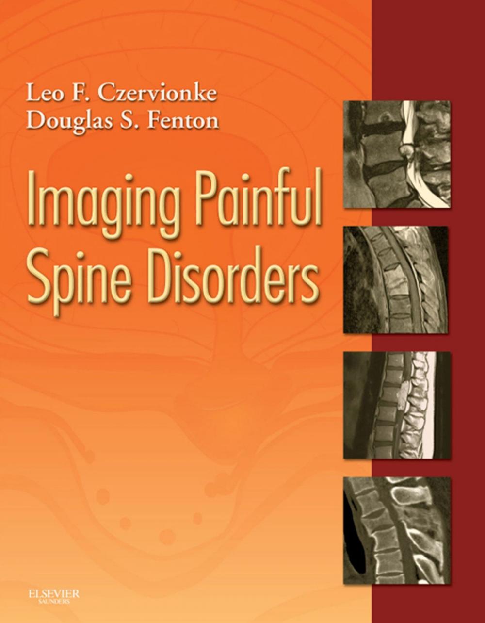 Big bigCover of Imaging Painful Spine Disorders E-Book