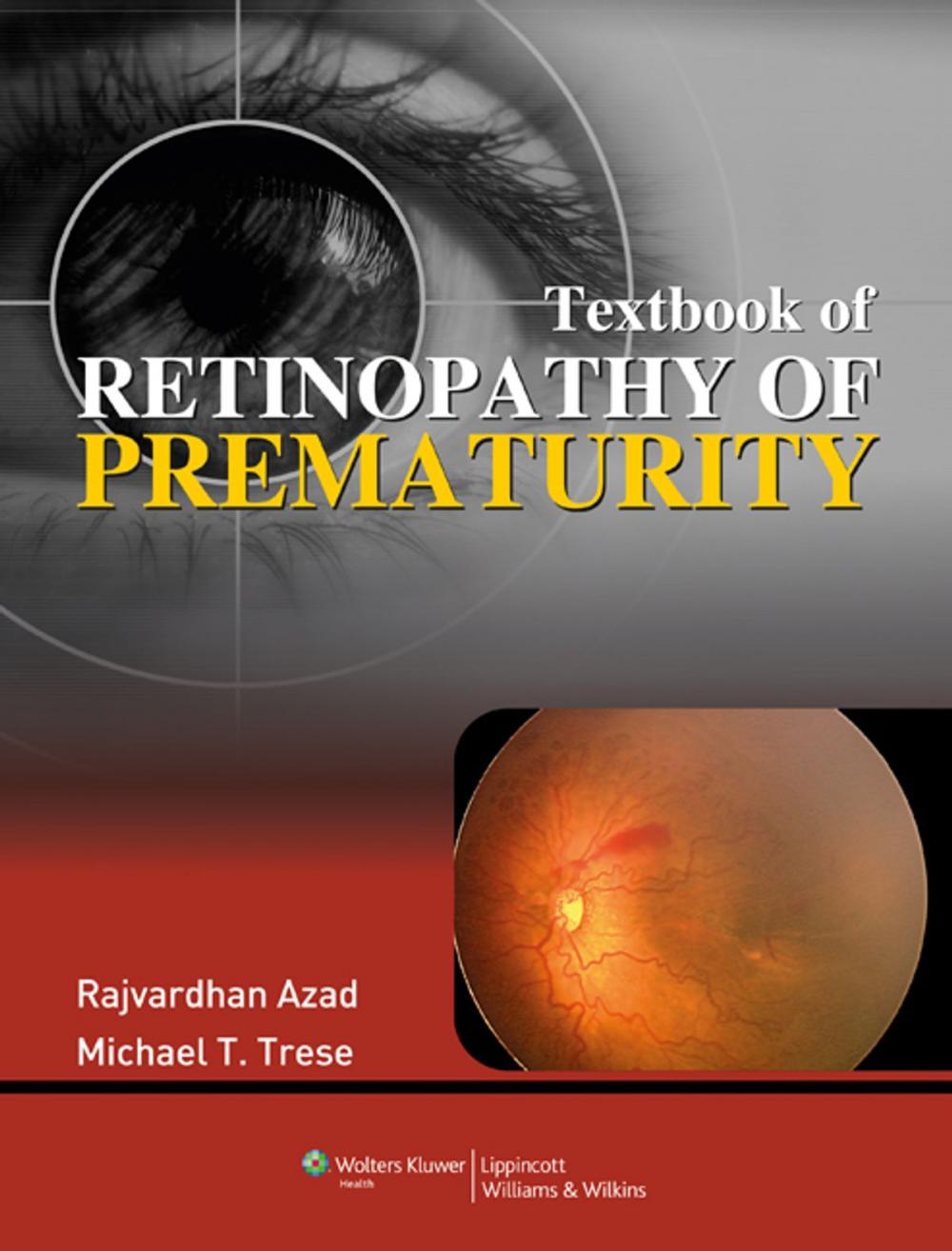 Big bigCover of Textbook of Retinopathy of Prematurity