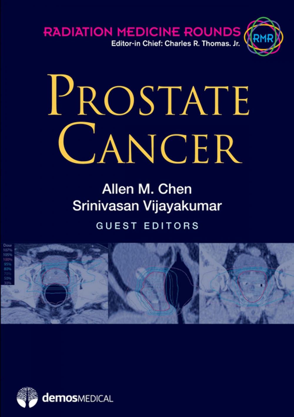 Big bigCover of Prostate Cancer