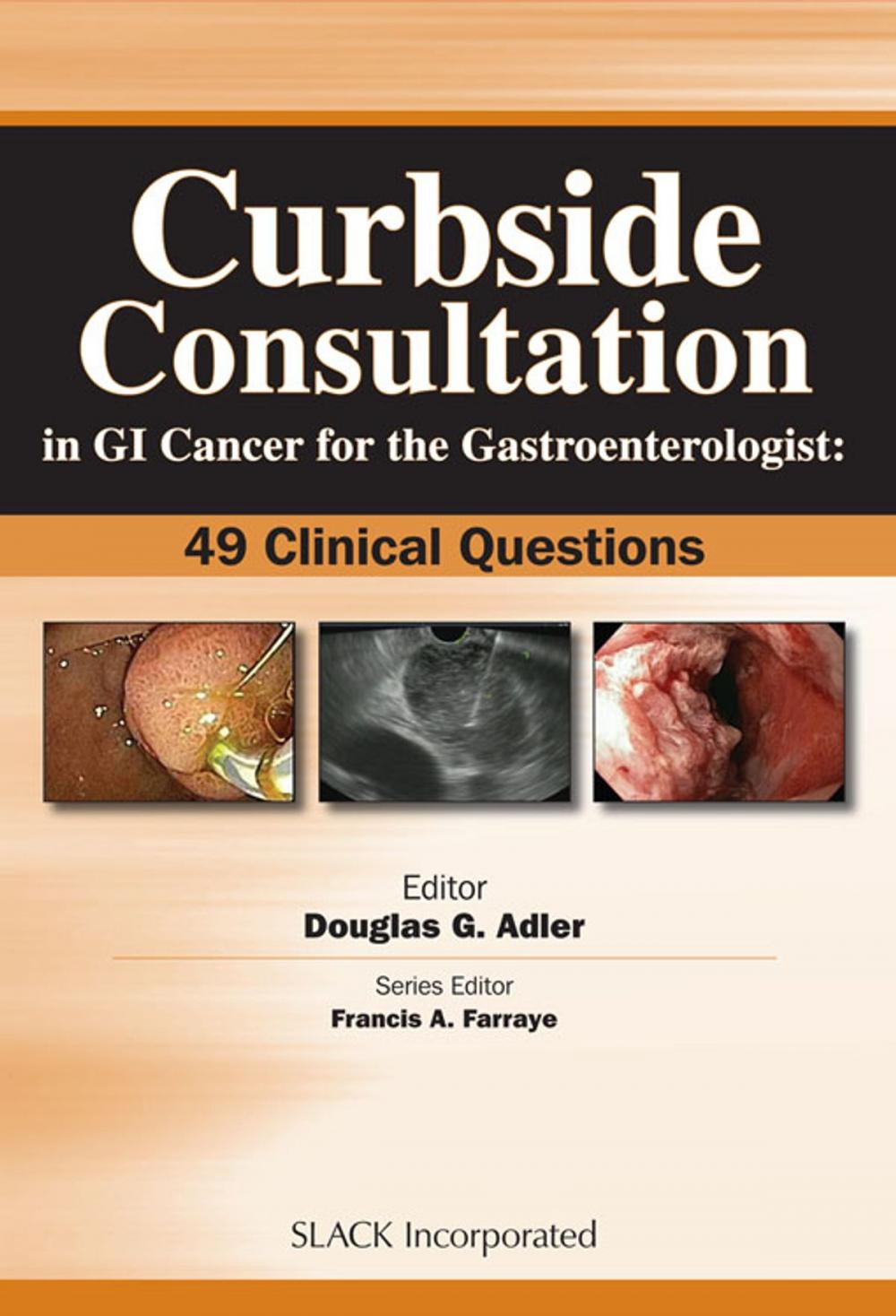 Big bigCover of Curbside Consultation in GI Cancer for the Gastroenterologist