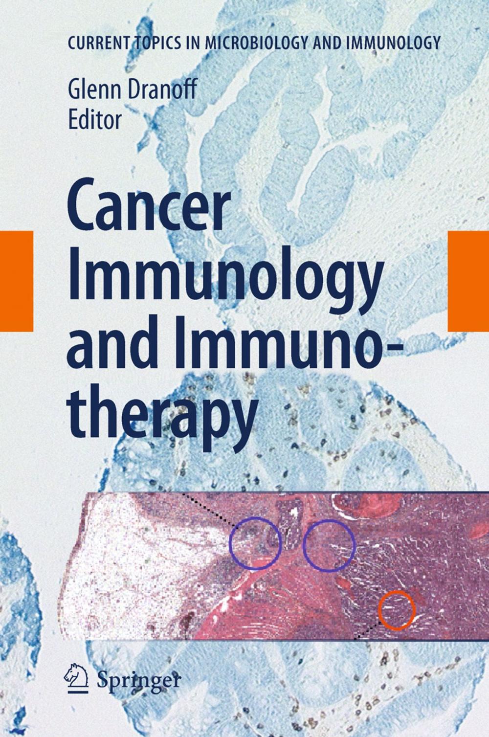 Big bigCover of Cancer Immunology and Immunotherapy