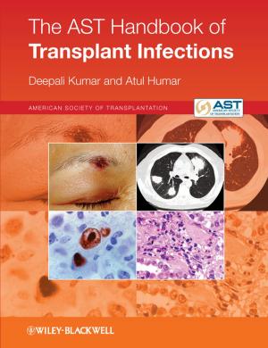 Cover of the book The AST Handbook of Transplant Infections by Judith Butler, Athena Athanasiou