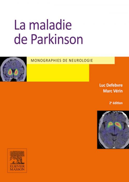 Cover of the book La maladie de Parkinson by Luc Defebvre, Marc Vérin, Elsevier Health Sciences France
