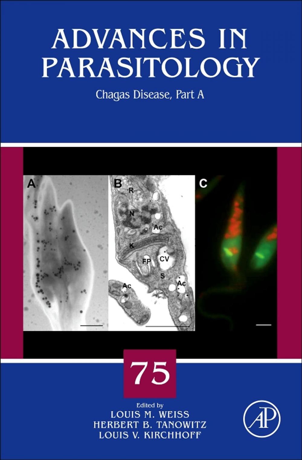 Big bigCover of Chagas Disease