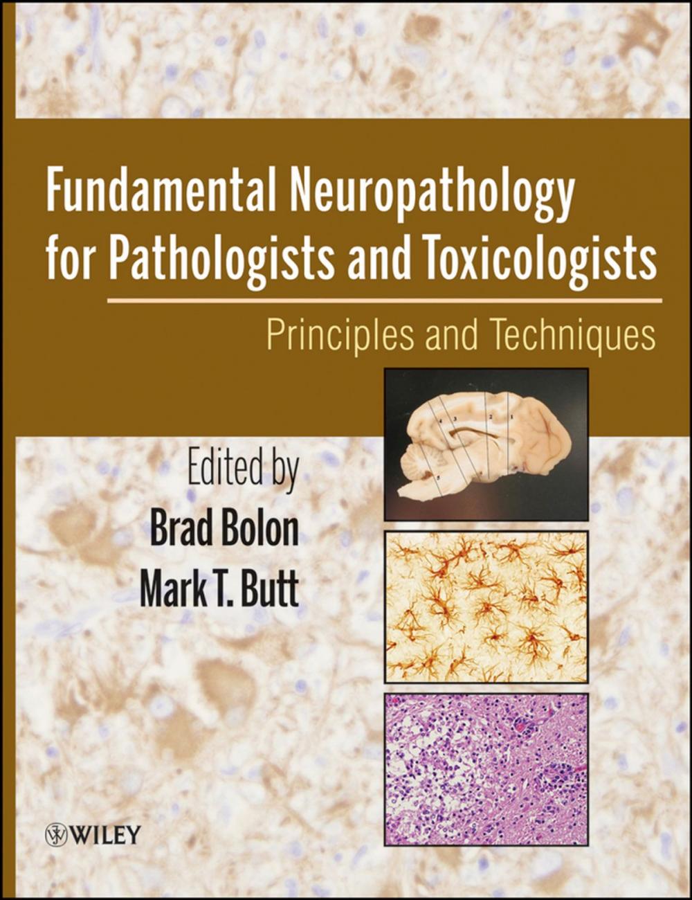 Big bigCover of Fundamental Neuropathology for Pathologists and Toxicologists