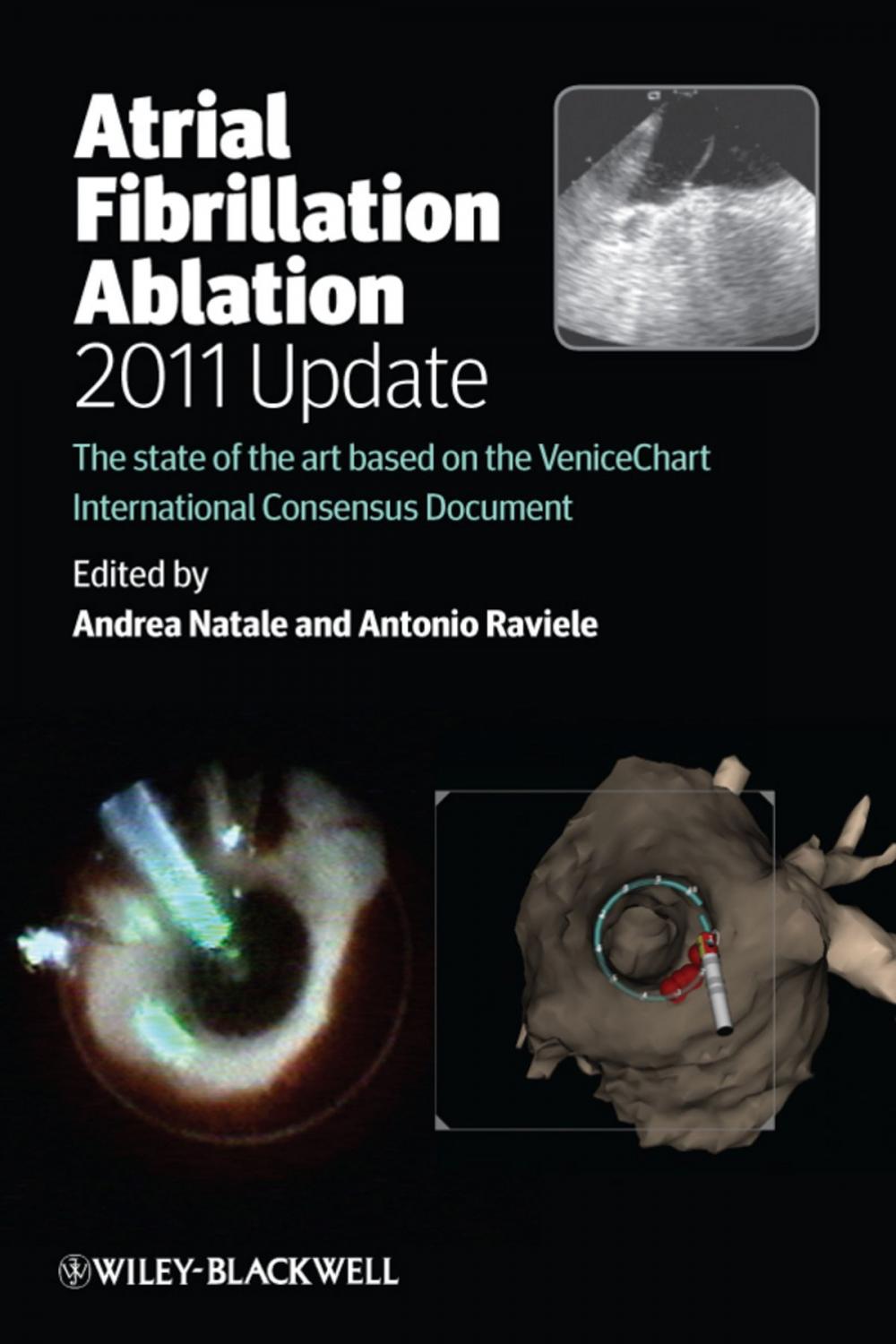 Big bigCover of Atrial Fibrillation Ablation, 2011 Update