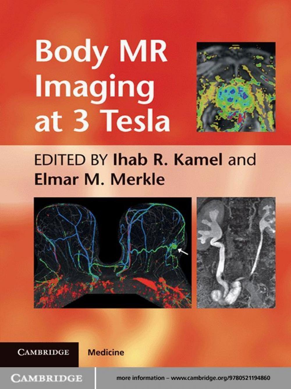 Big bigCover of Body MR Imaging at 3 Tesla