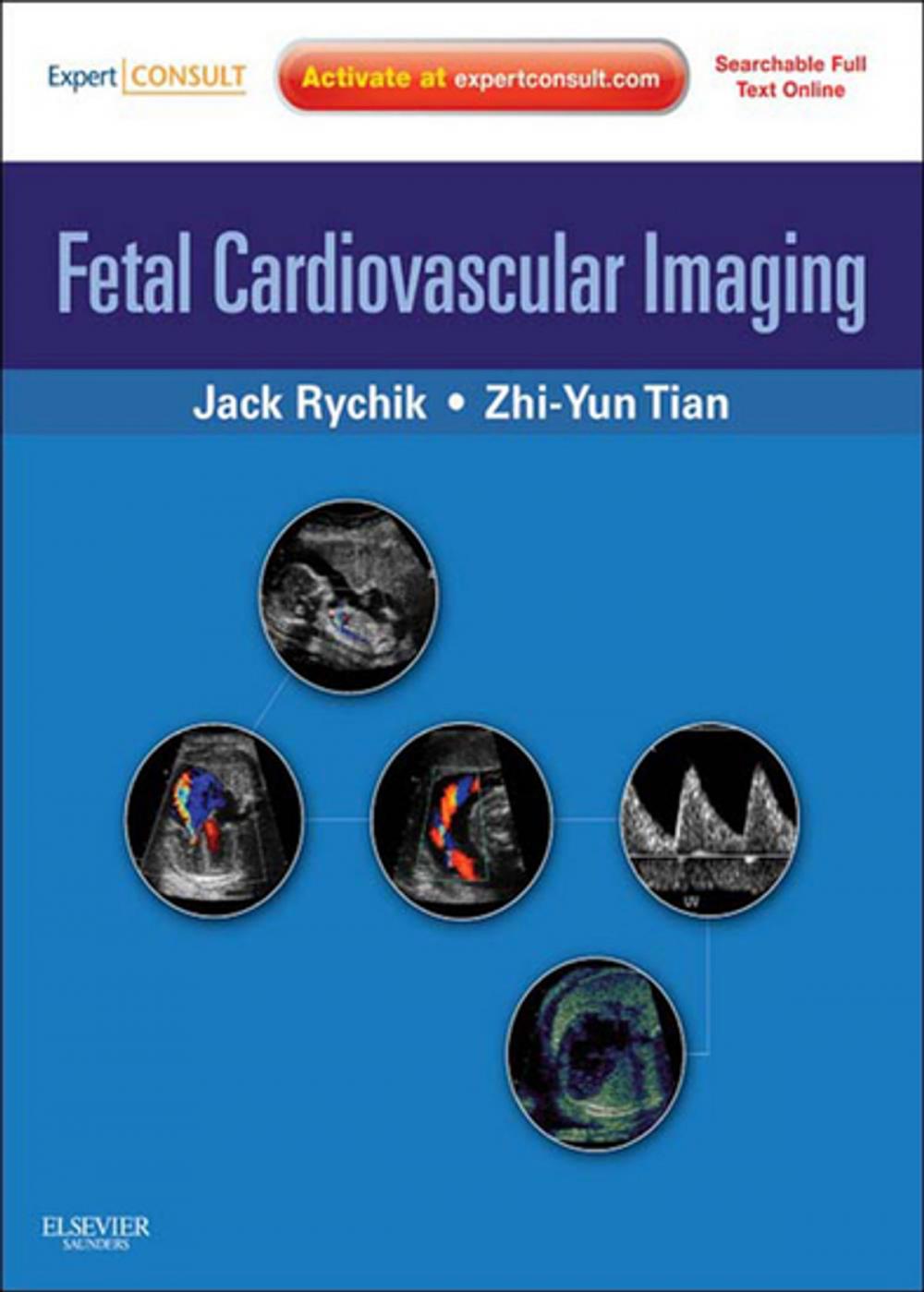 Big bigCover of Fetal Cardiovascular Imaging E-Book