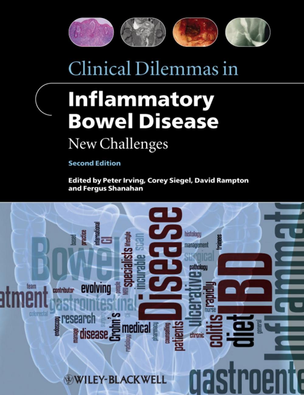 Big bigCover of Clinical Dilemmas in Inflammatory Bowel Disease