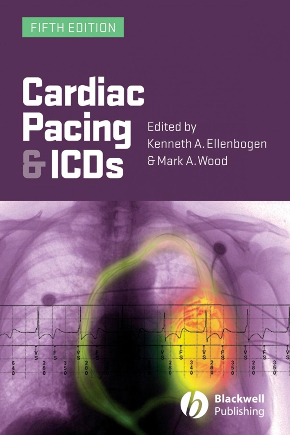 Big bigCover of Cardiac Pacing and ICDs