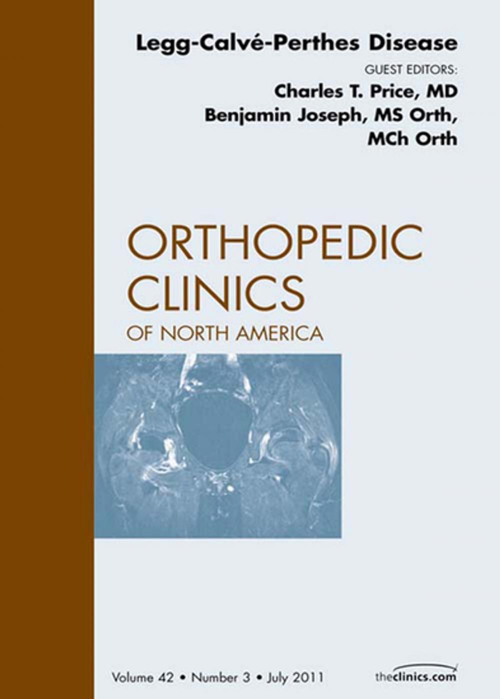 Big bigCover of Perthes Disease, An Issue of Orthopedic Clinics - E-Book