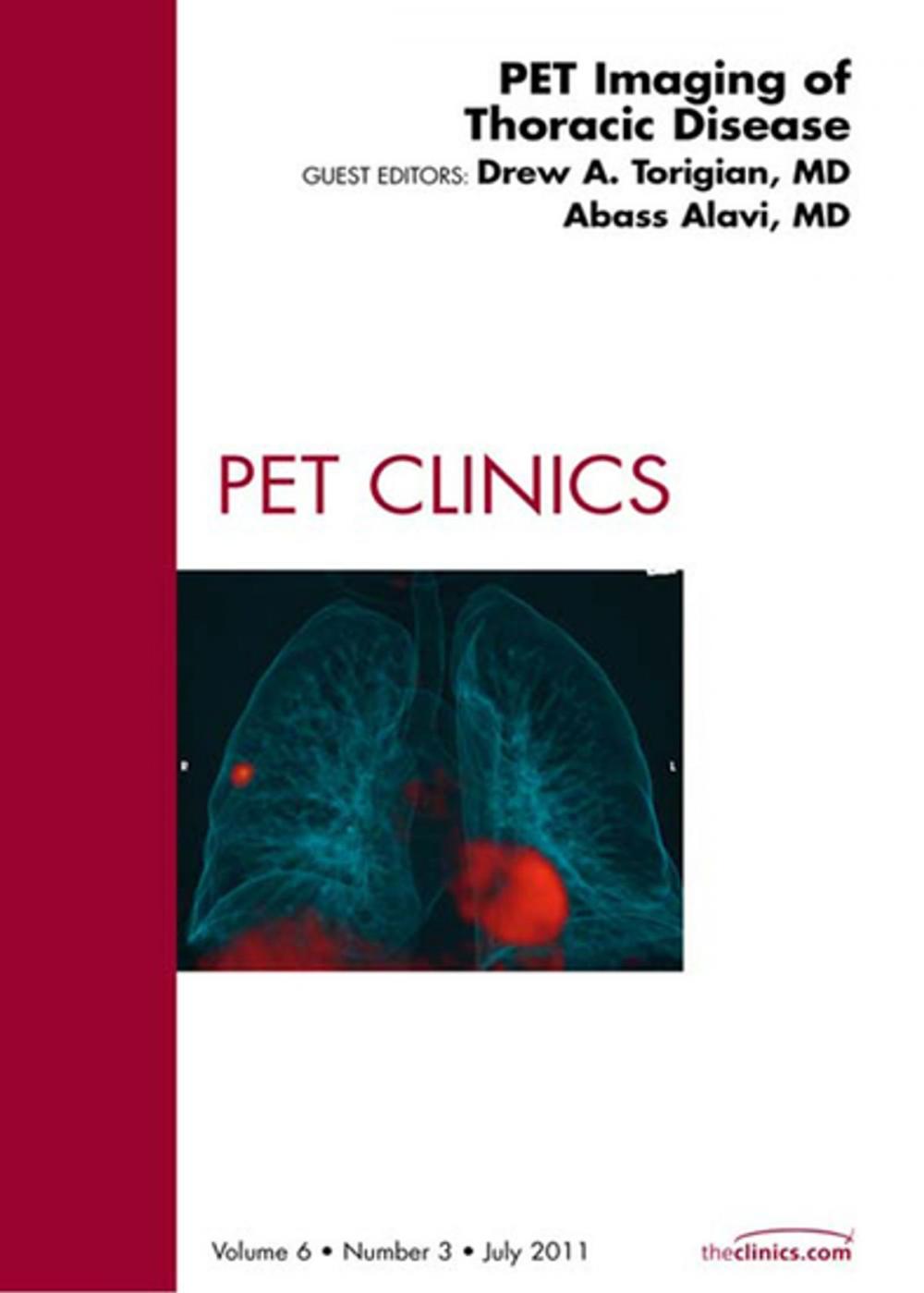 Big bigCover of PET Imaging of Thoracic Disease, An Issue of PET Clinics - E-Book