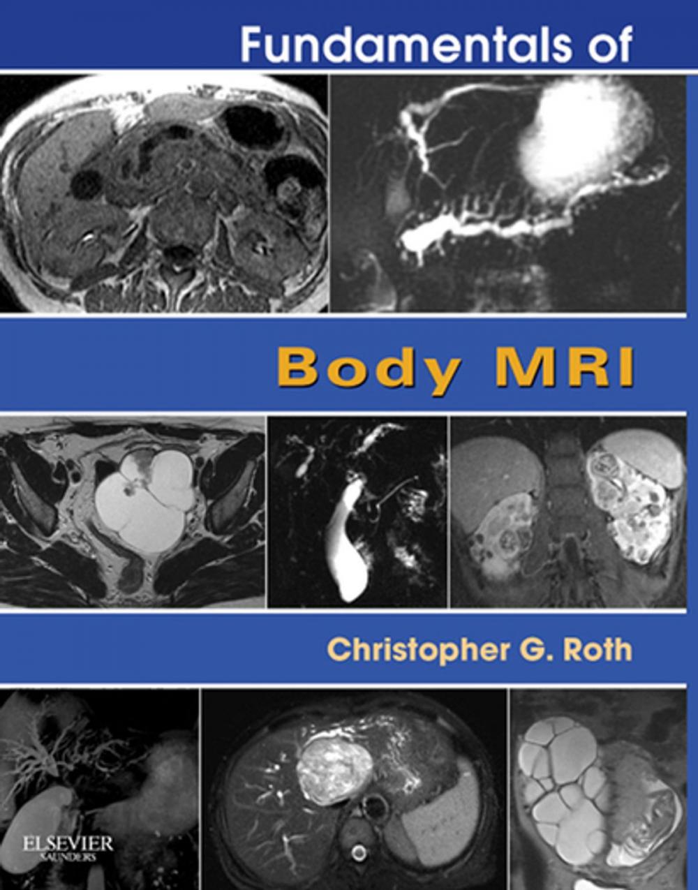 Big bigCover of Fundamentals of Body MRI E-Book