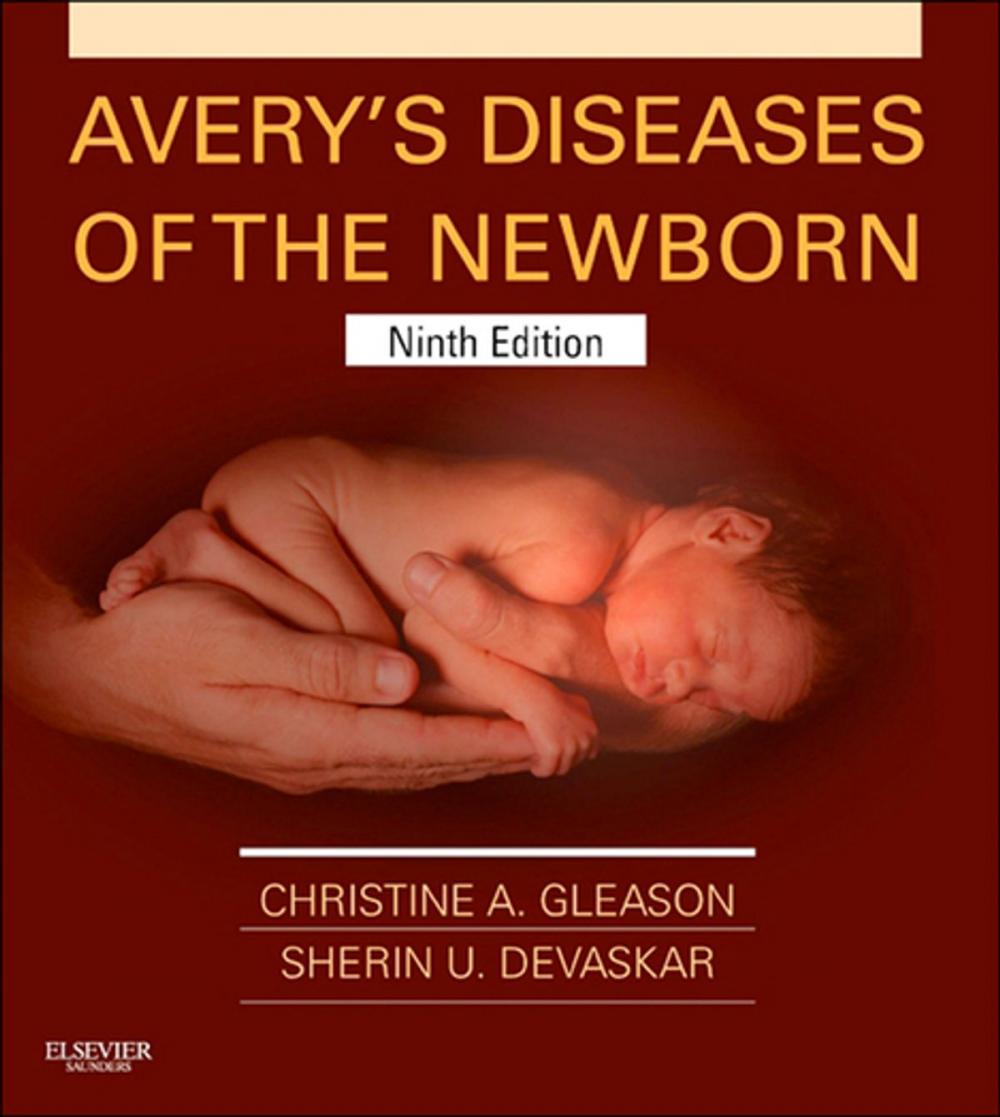 Big bigCover of Avery's Diseases of the Newborn E-Book