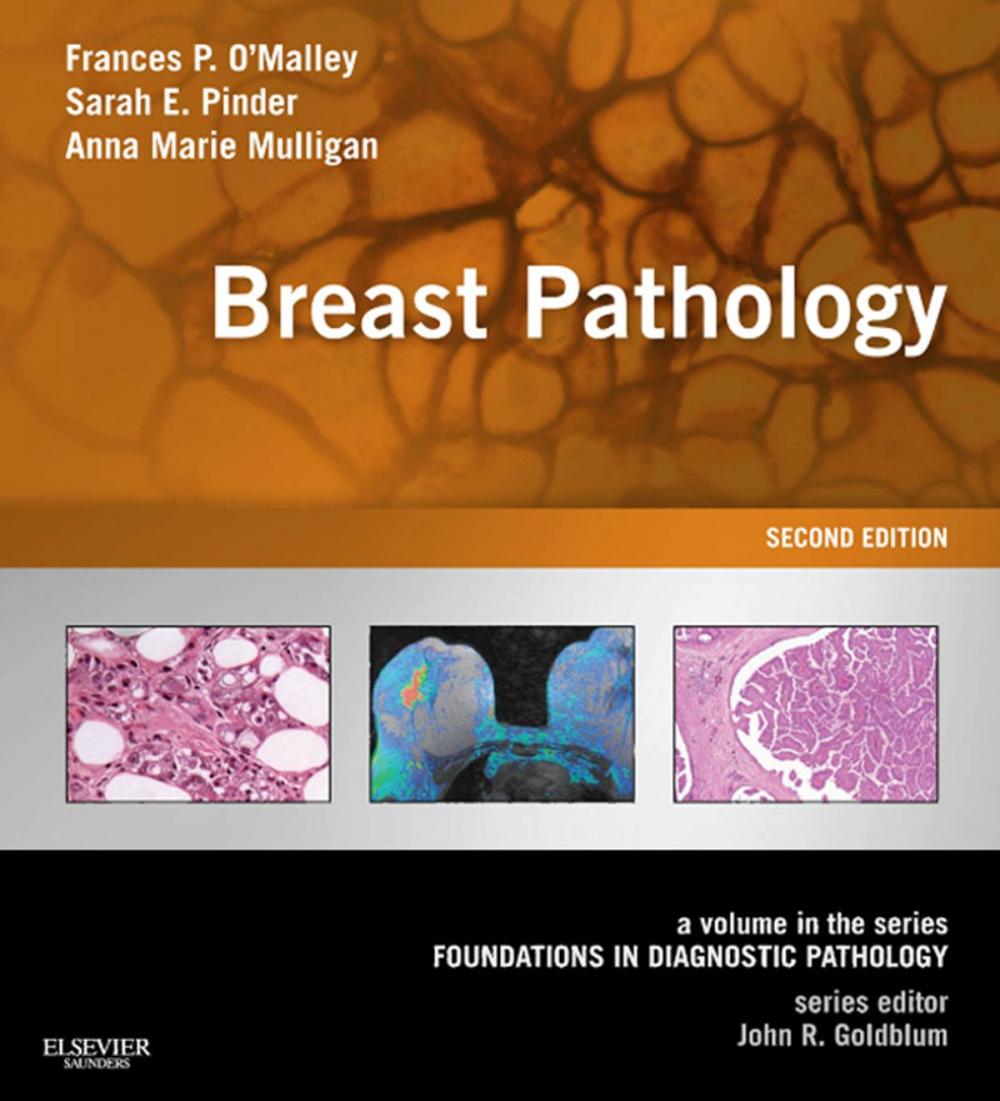 Big bigCover of Breast Pathology E-Book