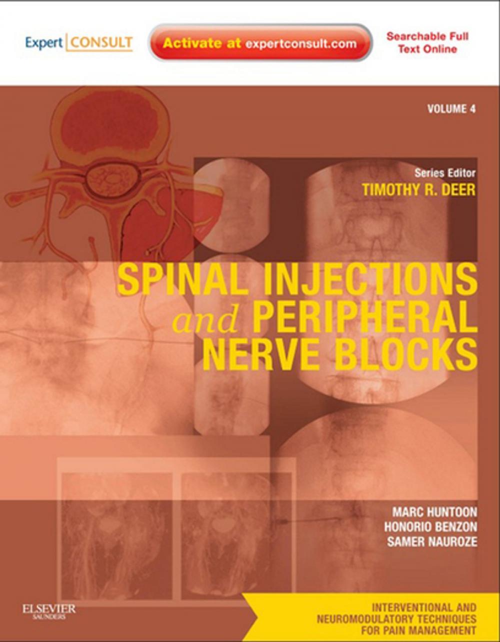 Big bigCover of Spinal Injections & Peripheral Nerve Blocks E-Book