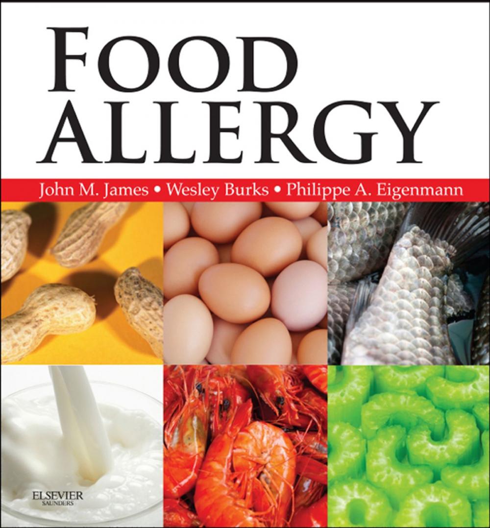 Big bigCover of Food Allergy E-Book