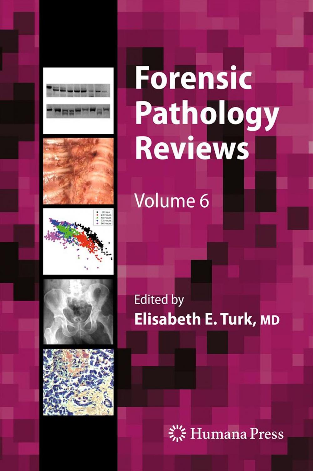 Big bigCover of Forensic Pathology Reviews