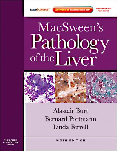 Cover of the book MacSween's Pathology of the Liver E-Book by Stefan G Hubscher, MD, Alastair D. Burt, MD, Bernard C. Portmann, MD, FRCPath, Linda D. Ferrell, MD, Elsevier Health Sciences