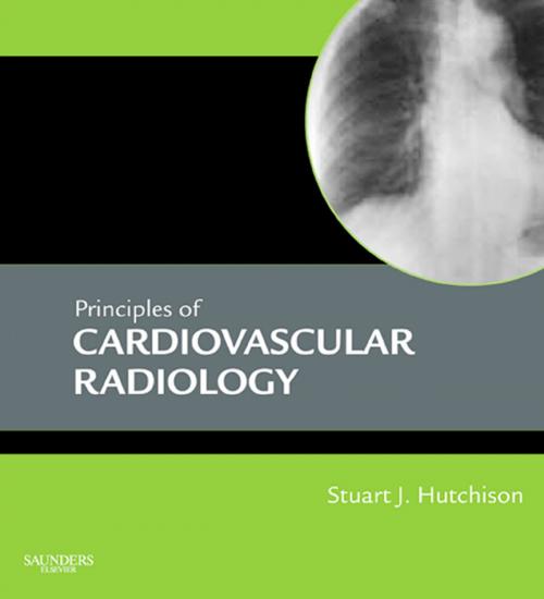 Cover of the book Principles of Cardiovascular Radiology E-Book by Stuart J. Hutchison, MD, FRCPC, FACC, FAHA, FASE, FSCMR, FSCCT, Elsevier Health Sciences