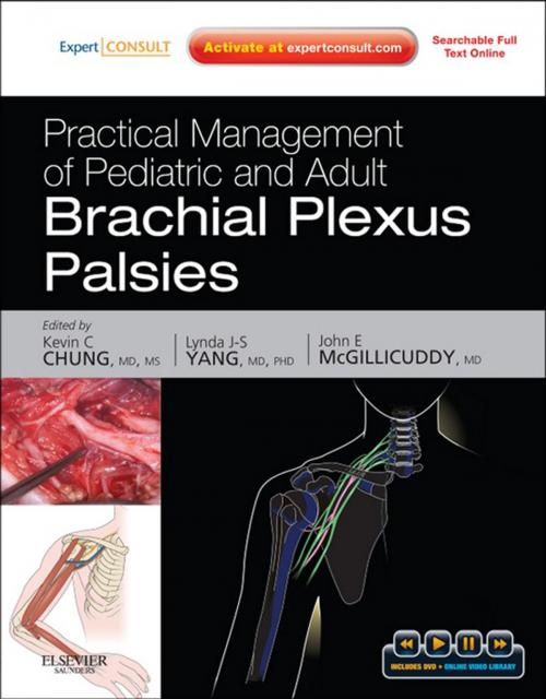 Cover of the book Practical Management of Pediatric and Adult Brachial Plexus Palsies E-Book by Kevin C. Chung, MD, MS, Lynda J-S Yang, MD, PhD, John E. McGillicuddy, MD, Elsevier Health Sciences