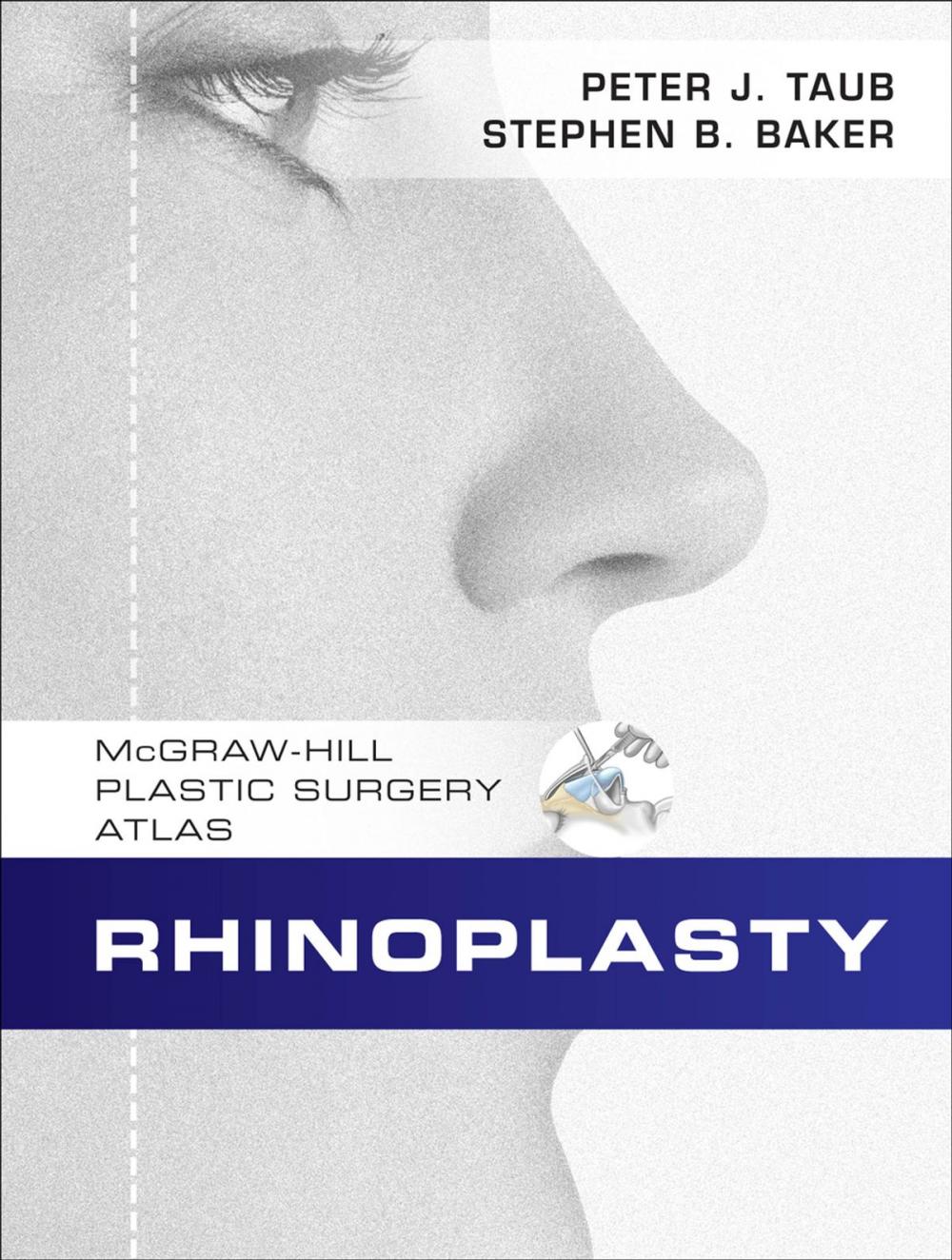 Big bigCover of Rhinoplasty