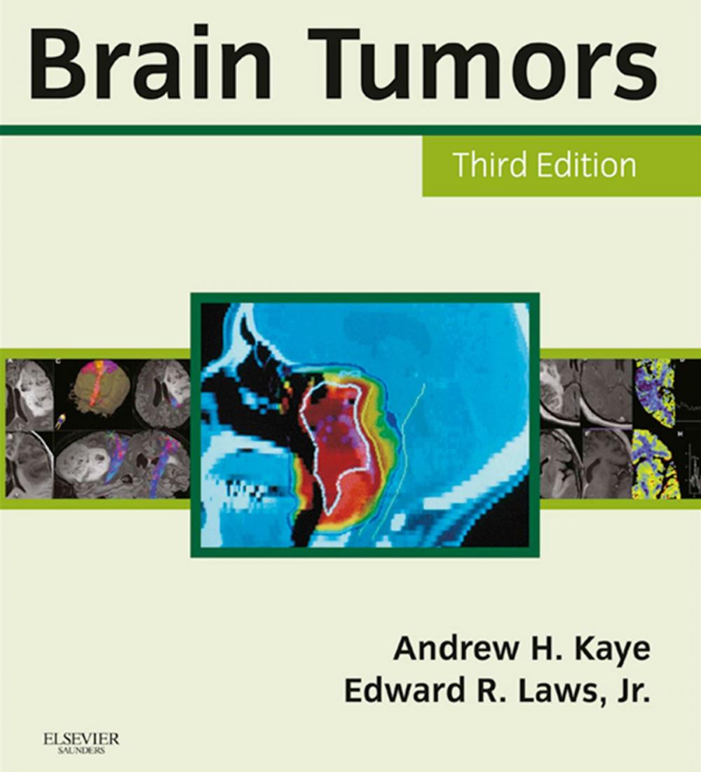 Big bigCover of Brain Tumors E-Book