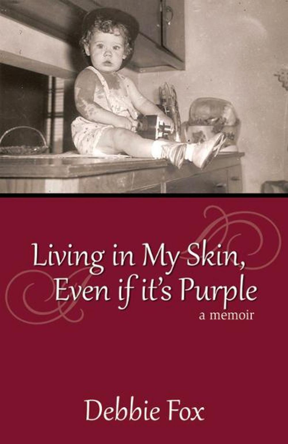 Big bigCover of Living In My Skin, Even If It's Purple