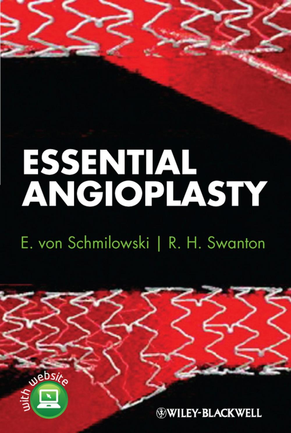 Big bigCover of Essential Angioplasty