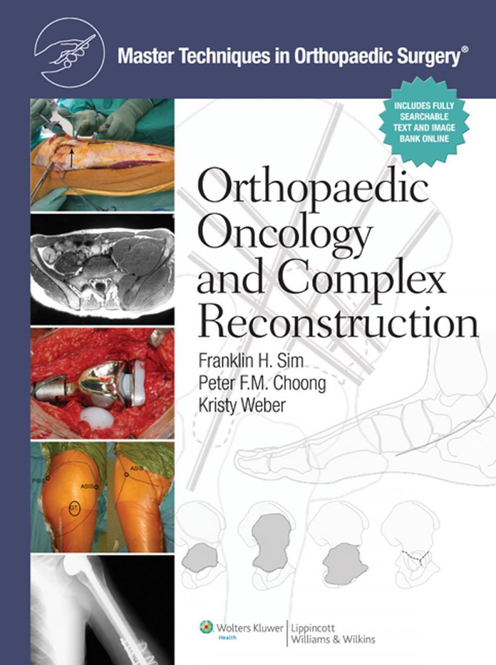 Big bigCover of Master Techniques in Orthopaedic Surgery: Orthopaedic Oncology and Complex Reconstruction