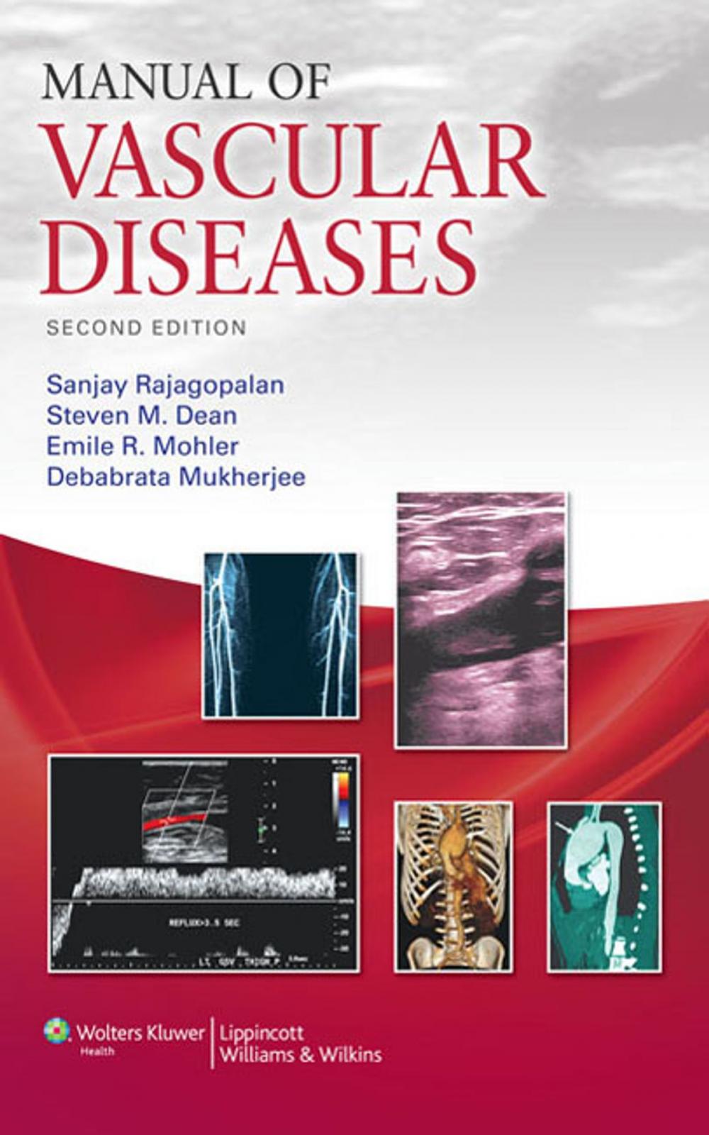 Big bigCover of Manual of Vascular Diseases