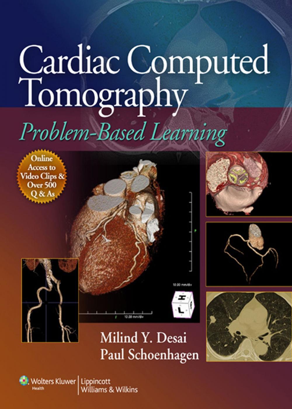 Big bigCover of Cardiac Computed Tomography