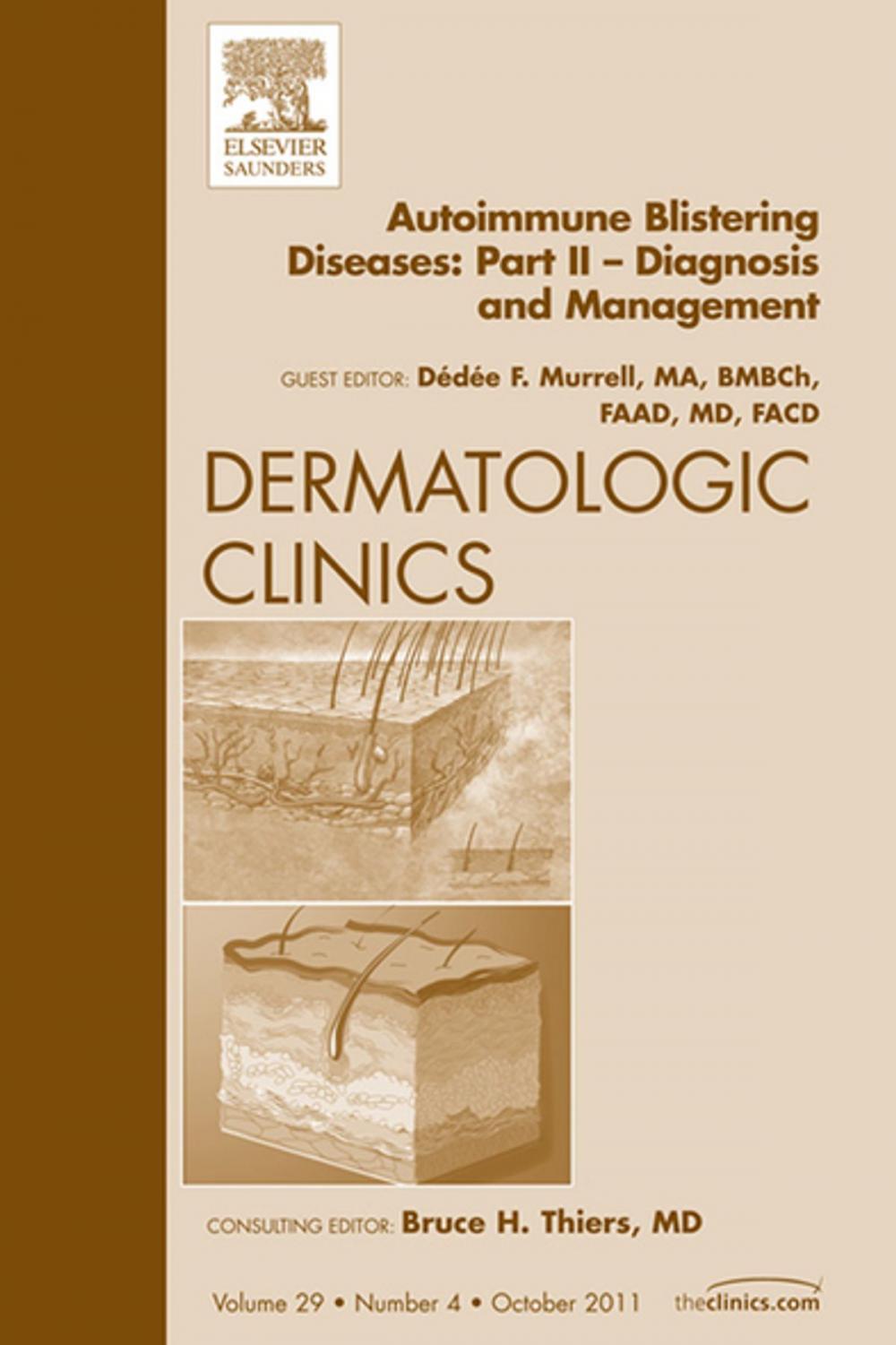 Big bigCover of Autoimmune Blistering Diseases, Part II, An Issue of Dermatologic Clinics - E-Book