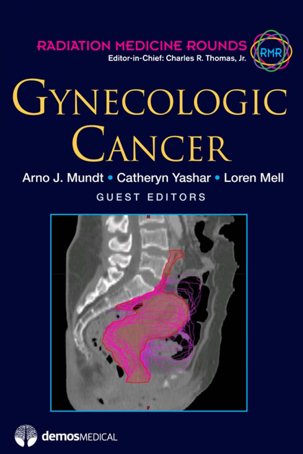 Big bigCover of Gynecologic Cancer