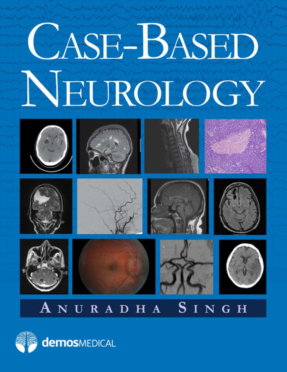 Big bigCover of Case-Based Neurology