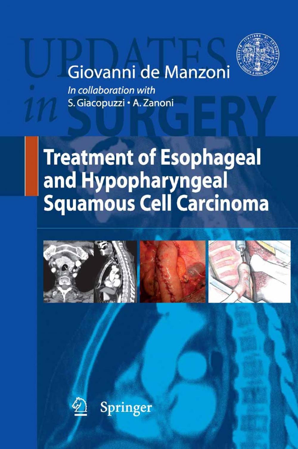 Big bigCover of Treatment of Esophageal and Hypopharingeal Squamous Cell Carcinoma