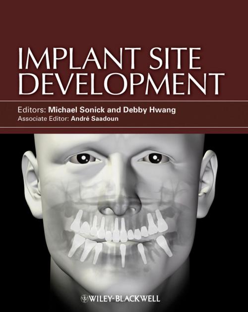 Cover of the book Implant Site Development by , Wiley