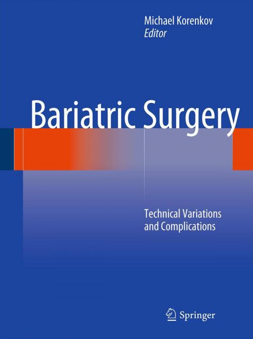 Cover of the book Bariatric Surgery by , Springer Berlin Heidelberg