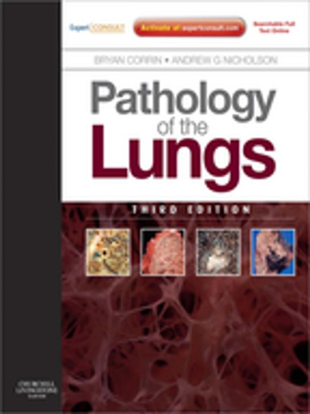 Big bigCover of Pathology of the Lungs E-Book