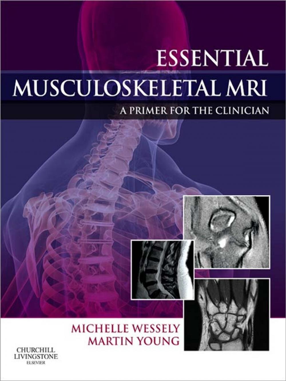 Big bigCover of Essential Musculoskeletal MRI