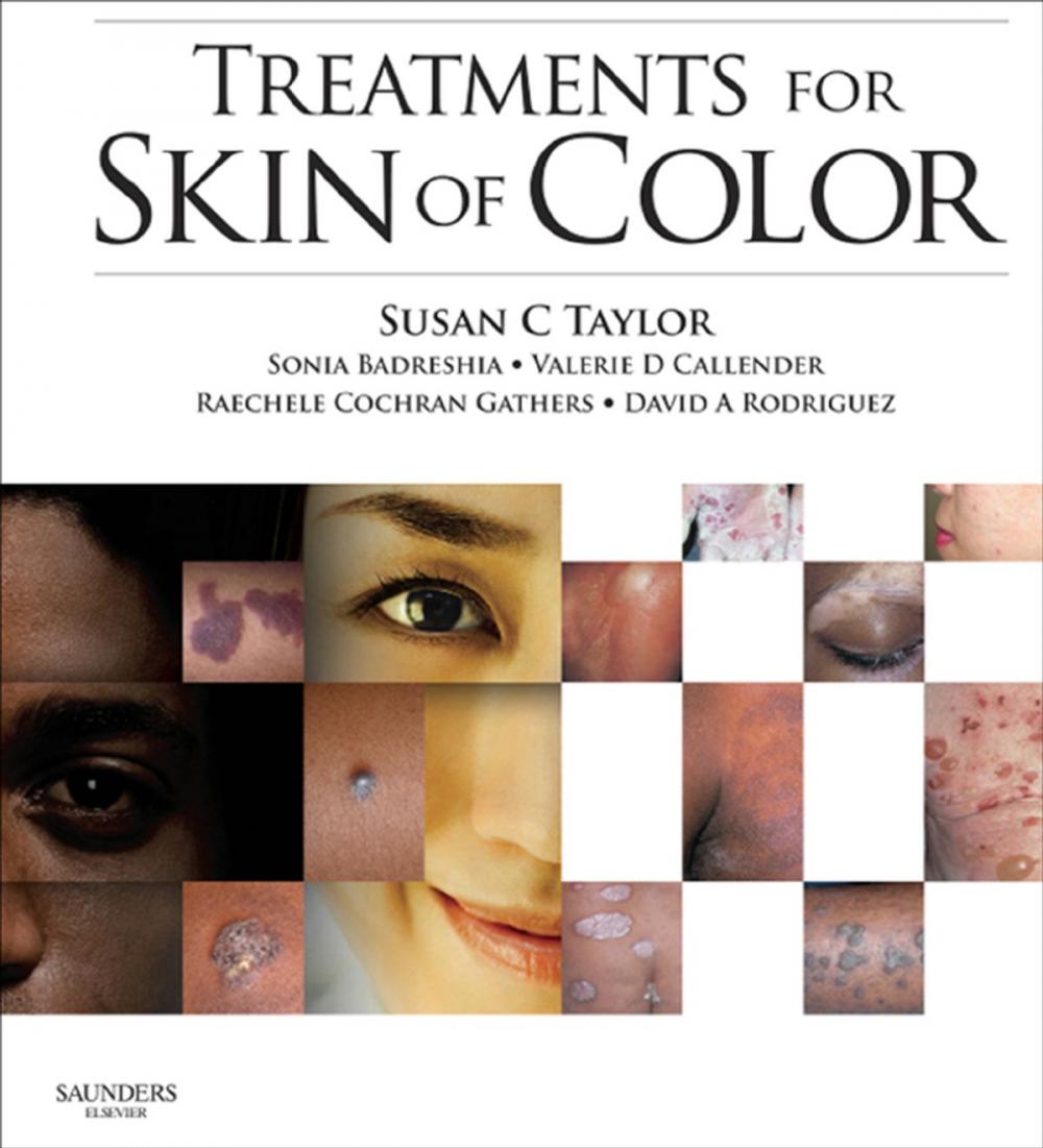 Big bigCover of Treatments for Skin of Color E-Book