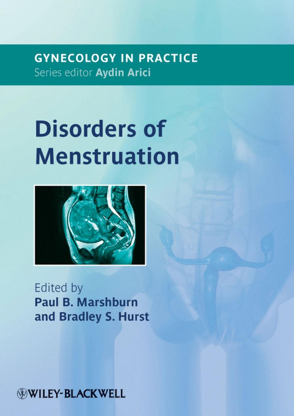 Big bigCover of Disorders of Menstruation