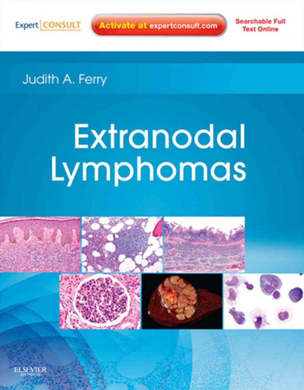 Big bigCover of Extranodal Lymphomas E-Book