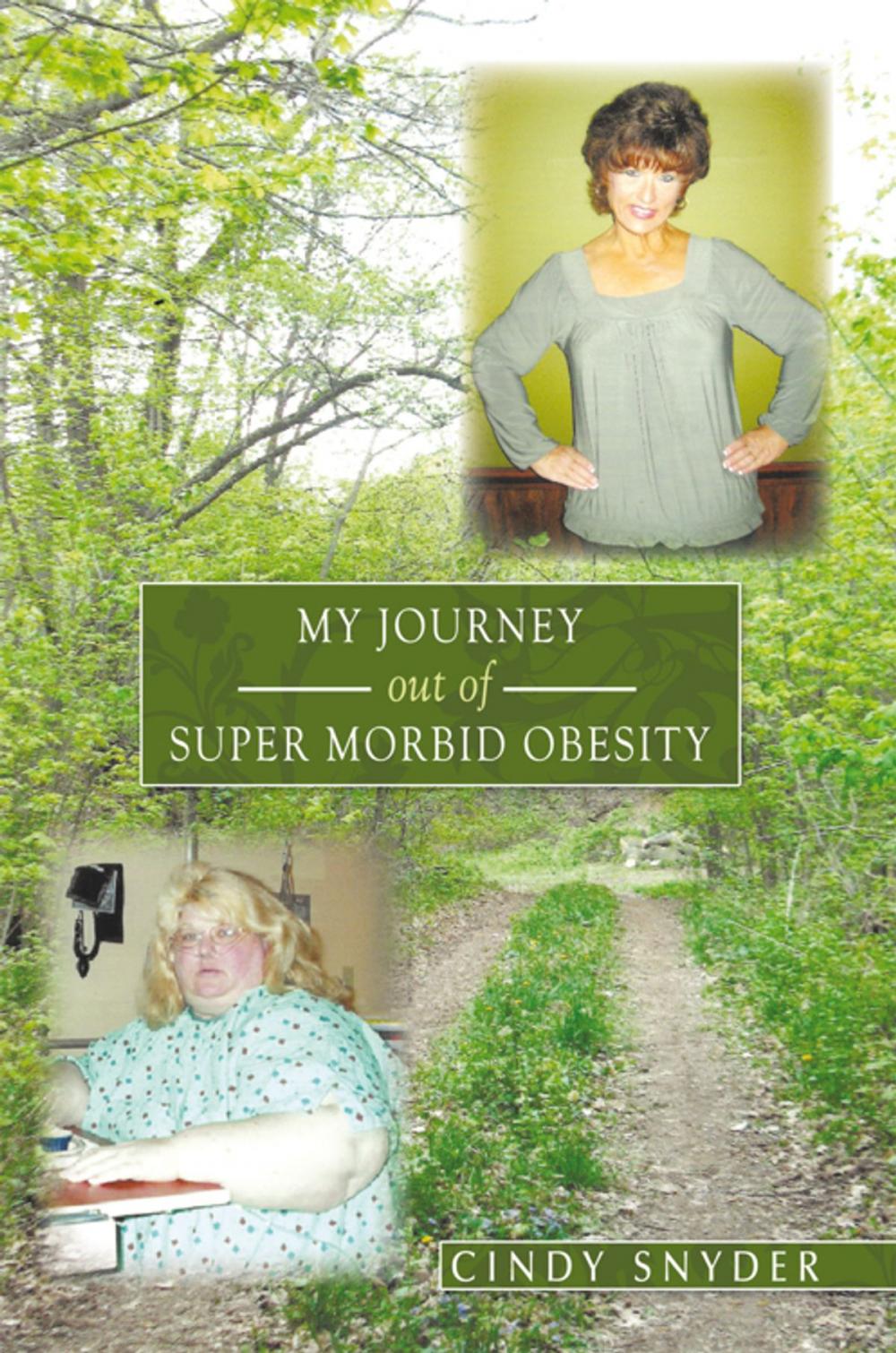 Big bigCover of My Journey out of Super Morbid Obesity