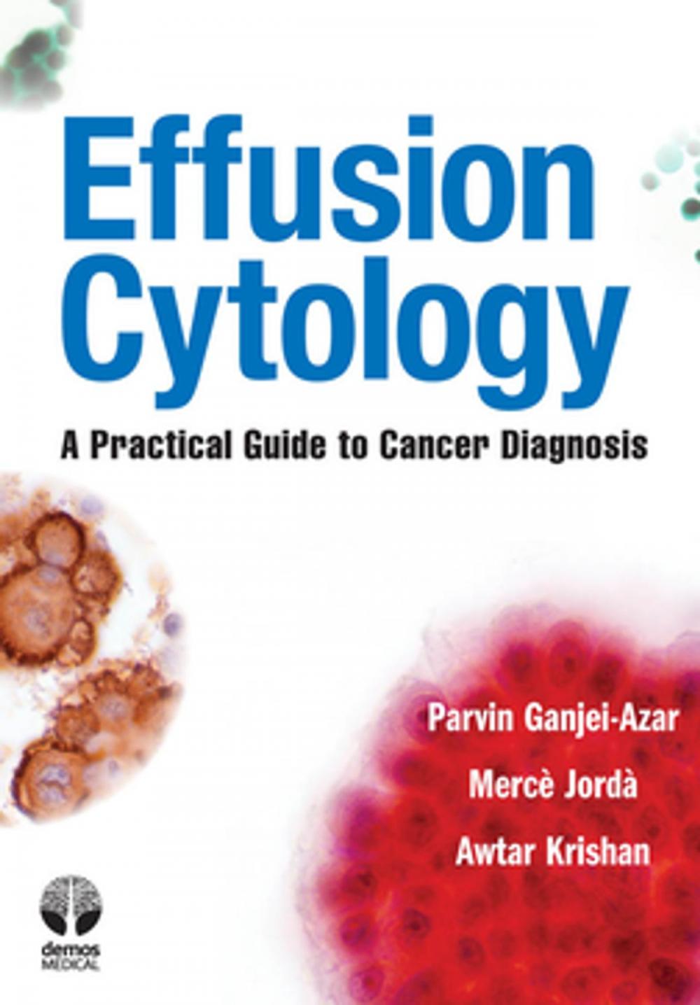 Big bigCover of Effusion Cytology